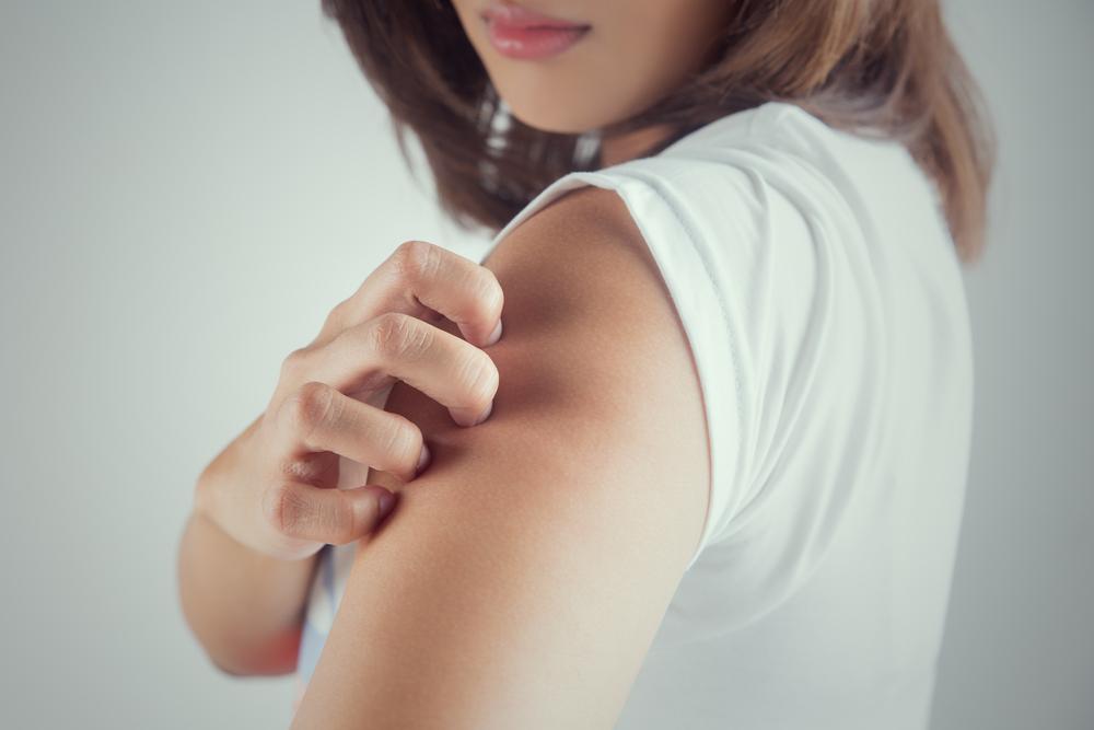 10 Reasons Why You Get Hives