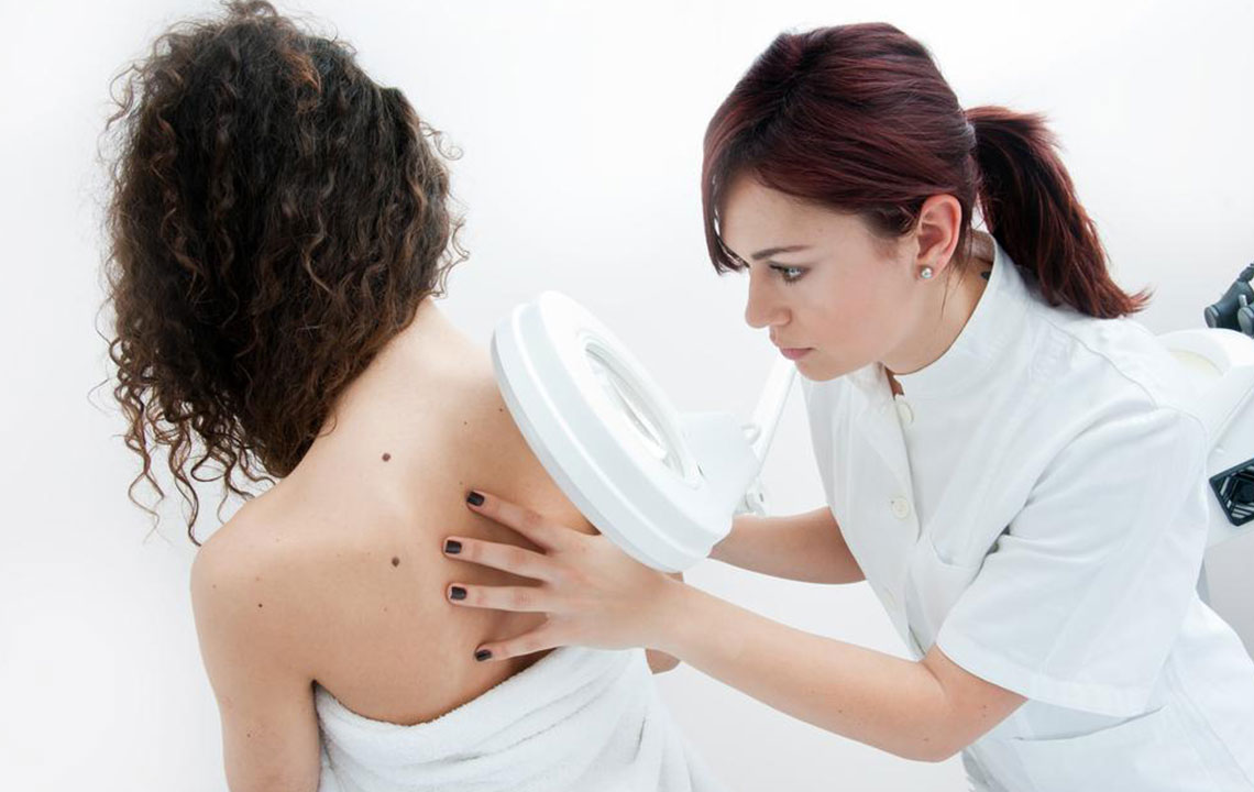 5 ways to reduce the risk of melanoma