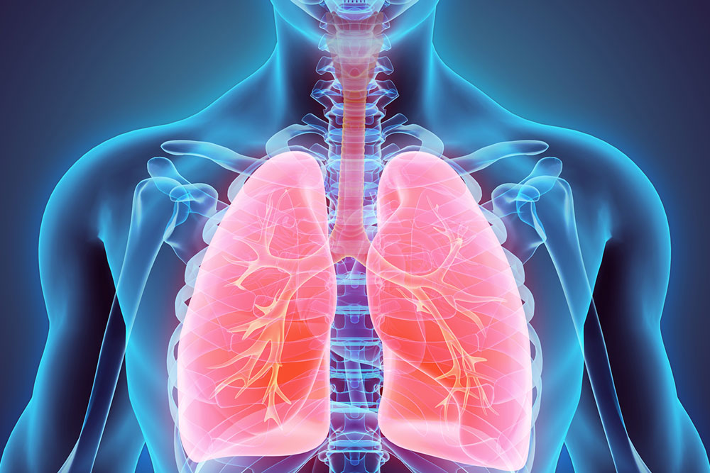 Non-Small Cell Lung Cancer – Causes, Symptoms, and Treatment