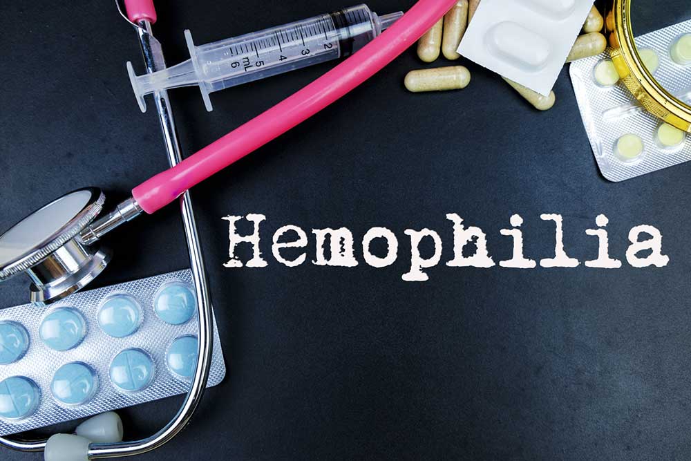 Causes, Symptoms, and Complications of Hemophilia