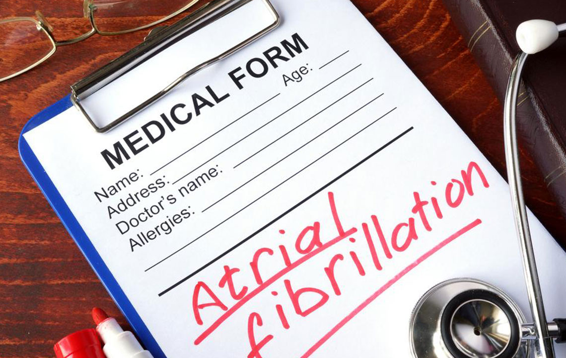 Symptoms, Diagnosis and Treatment of Atrial Fibrillation